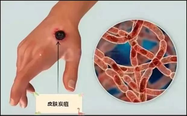 图文